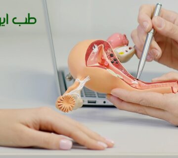 درمان فیبروم رحم با طب سنتی
