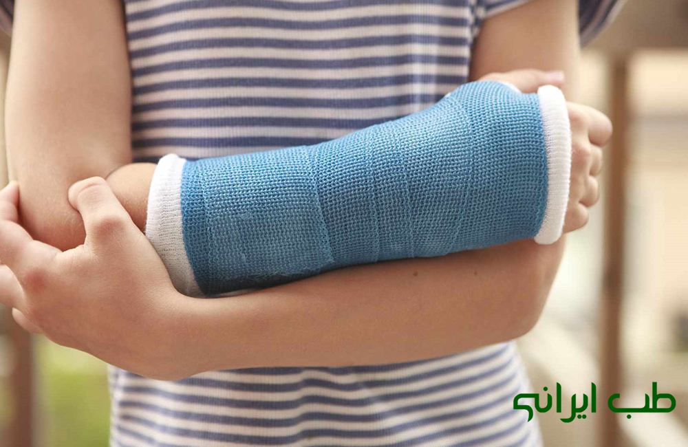 داروی گیاهی برای جوش خوردن استخوان