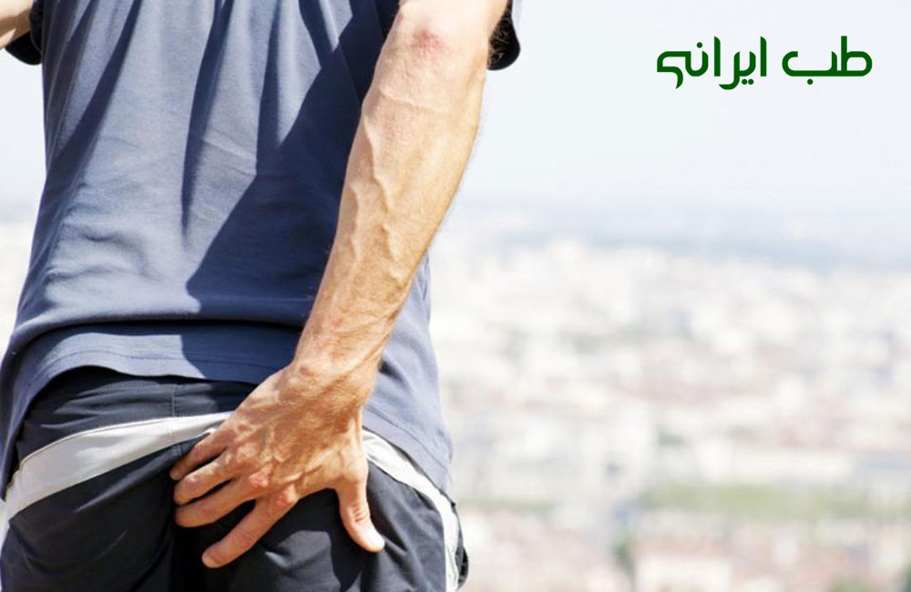 درمان سنتی جوش مقعدی