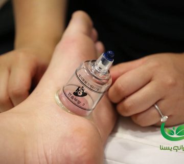 حجامت پا