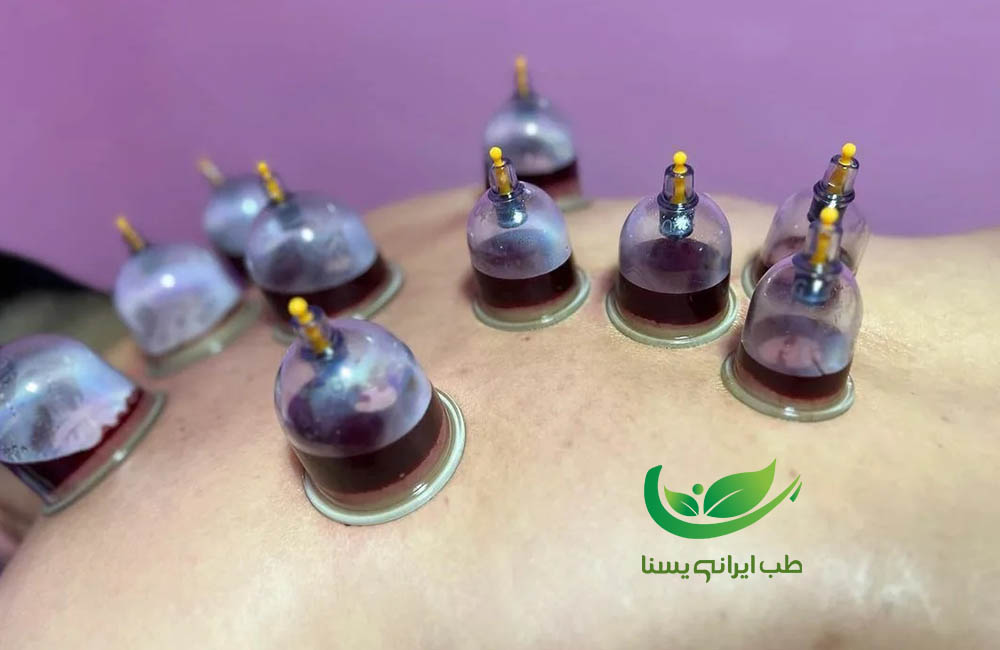 تقویم حجامت
